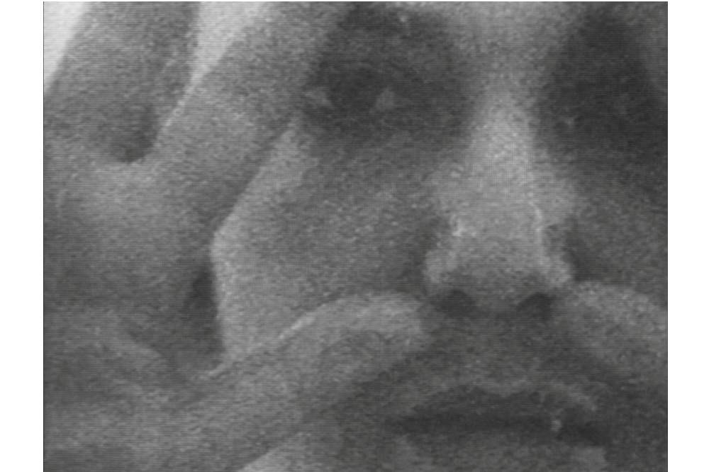 Fought Through Women&rsquo;s Bodies: Mona Hatoum&rsquo;s Early Performances