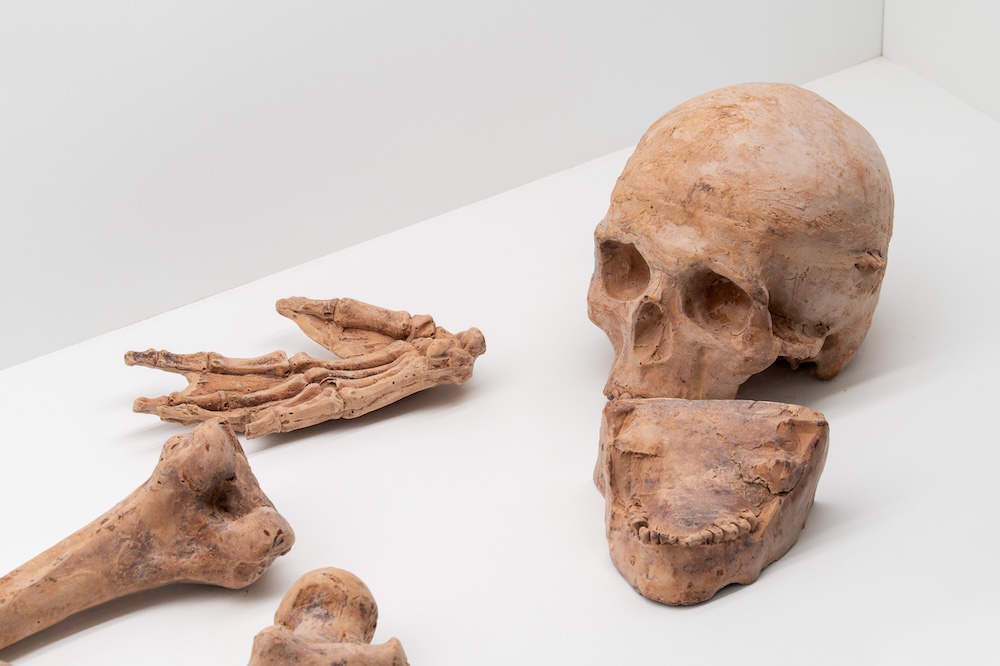 Body Believing: Jana Sterbak at Musée des Hospitalières and Esker Foundation